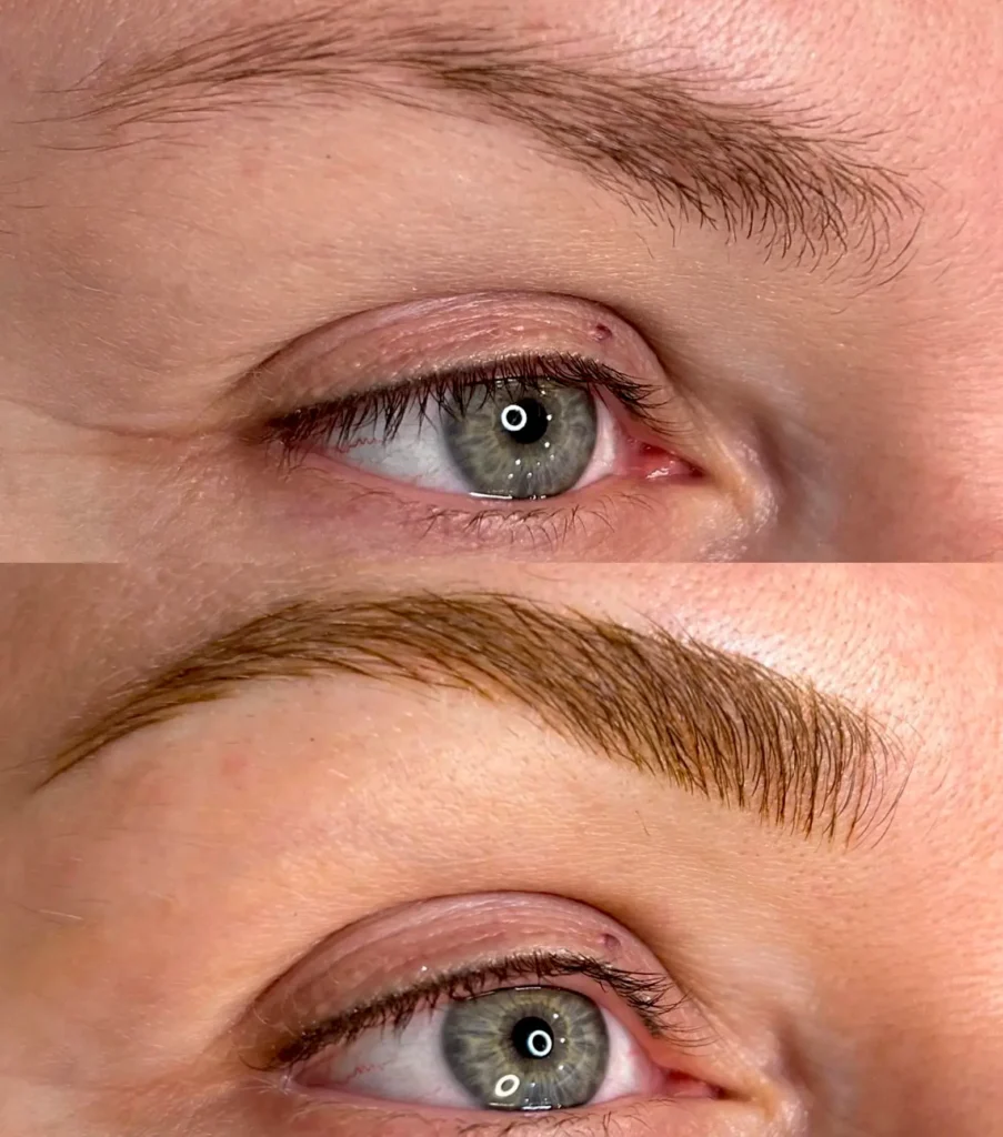Flat Brows With No Lift