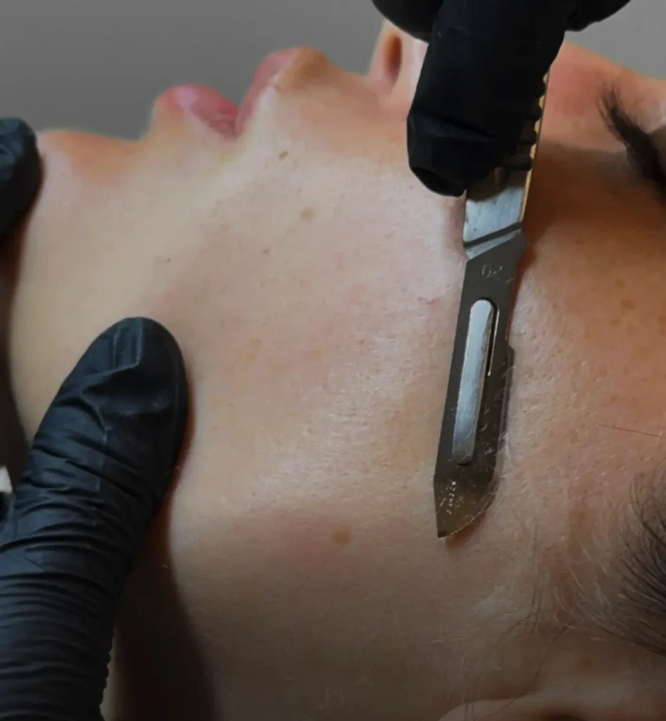 Post-Treatment Care