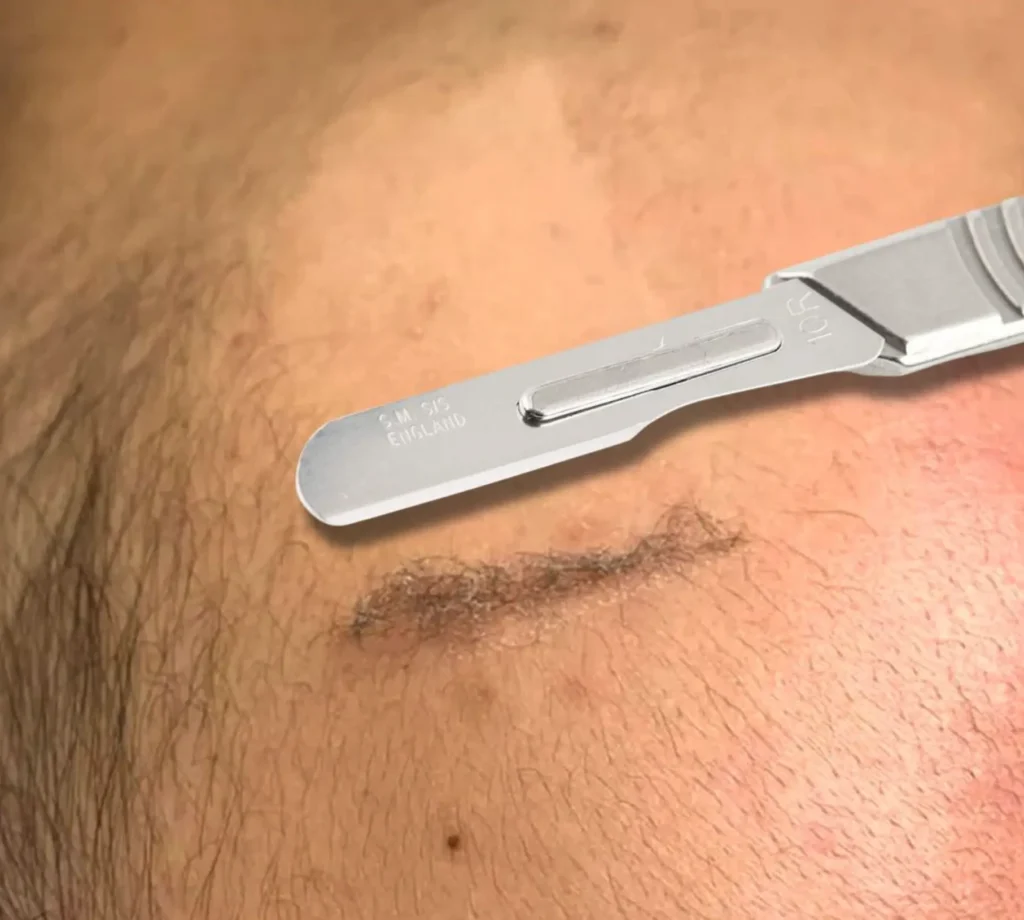 Technique Tips
